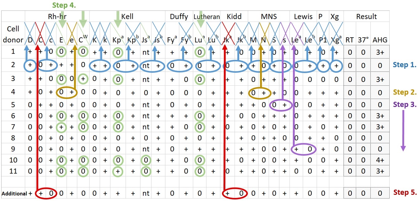 Educational antibody panel with reagent cell rows, blood-group antigen columns, reaction results at RT, 37 degrees, and AHG, and colored interpretation annotations.